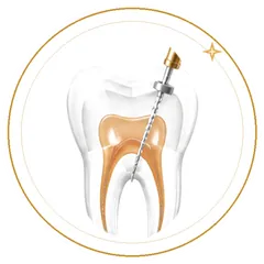 Endodoncia