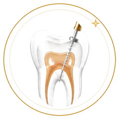 Endodoncia